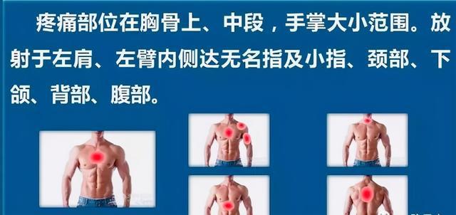 55岁男性突发胸痛，全面解析原因、应急措施与预防方法